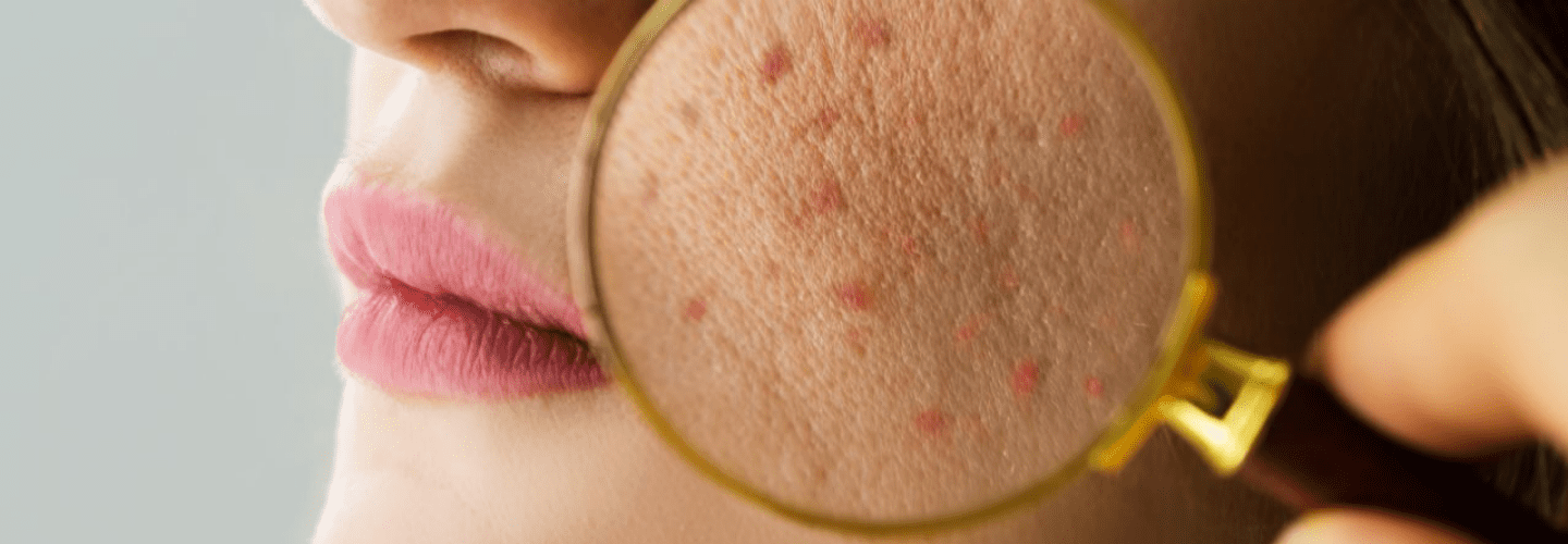 Best Dermatologist in Udaipur Best Dermatologist in Udaipur