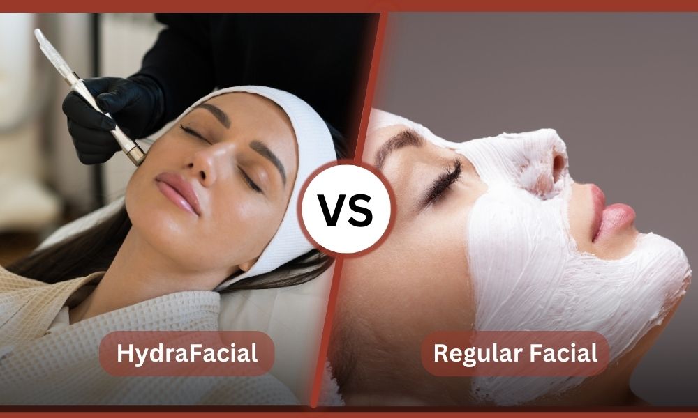Reasons Why You Might Choose HydraFacial Over a Regular Facial