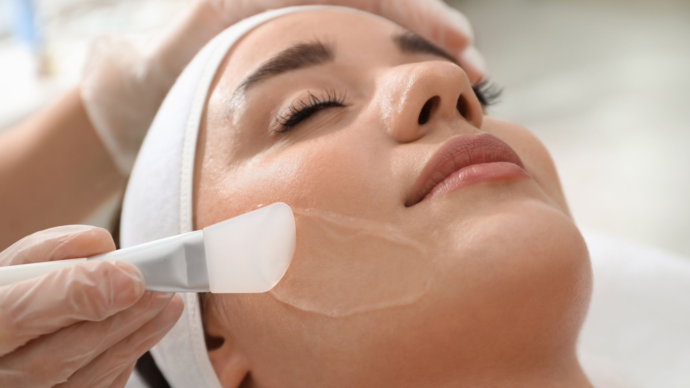 Non-Surgical Skin Treatments - chemical peels