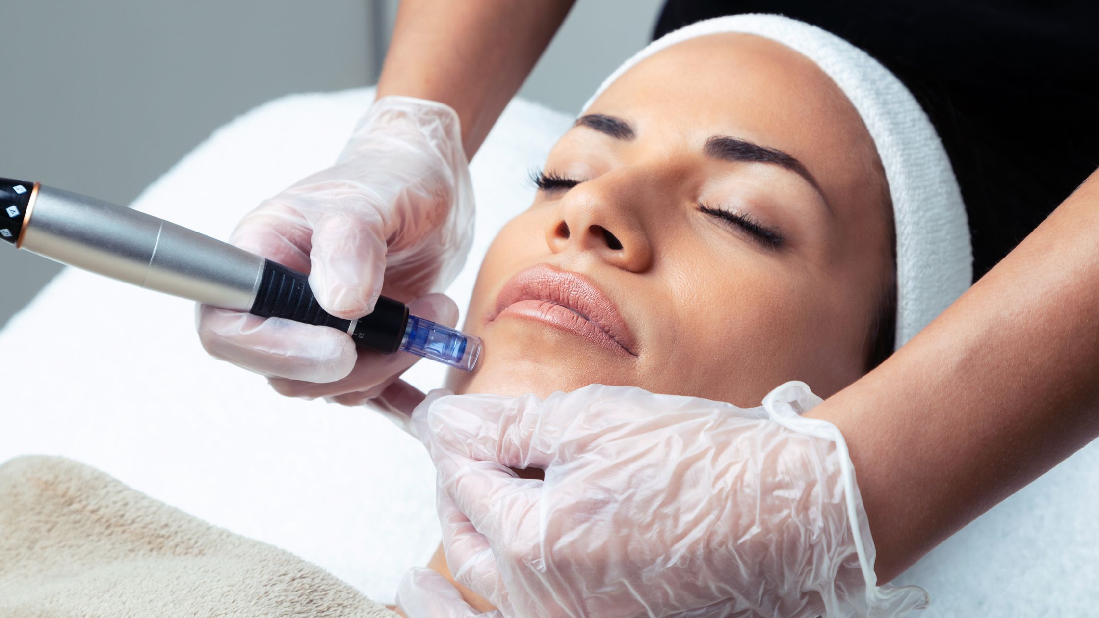 Non-Surgical Skin Treatments - microneedling