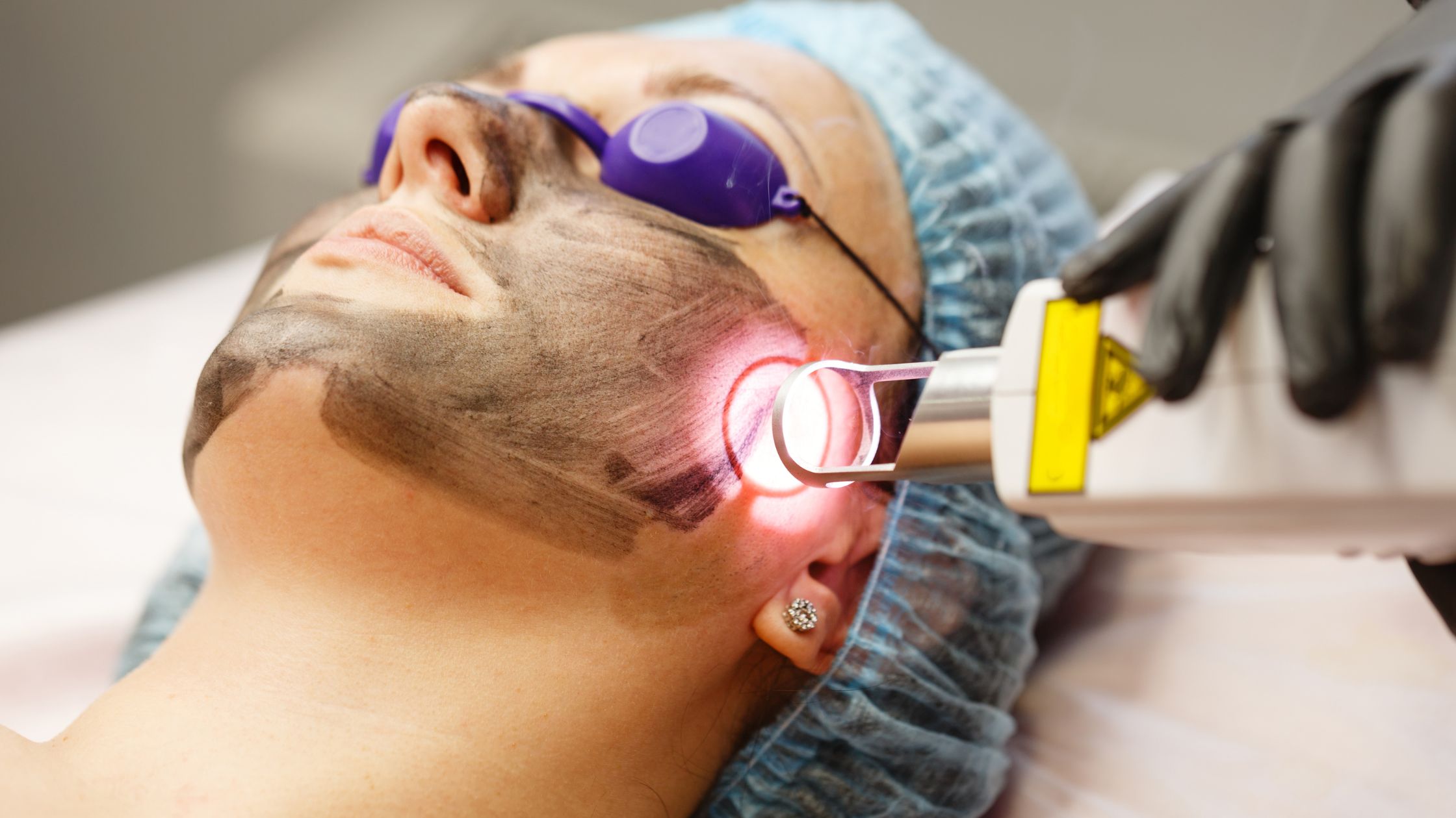 Non-Surgical Skin Treatments - skin resurfacing