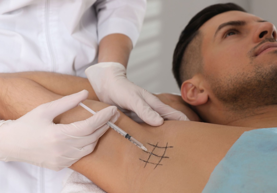 Say Goodbye to Sweating with Hyperhidrosis Treatment