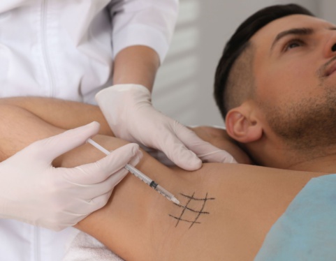 Say Goodbye to Sweating with Hyperhidrosis Treatment
