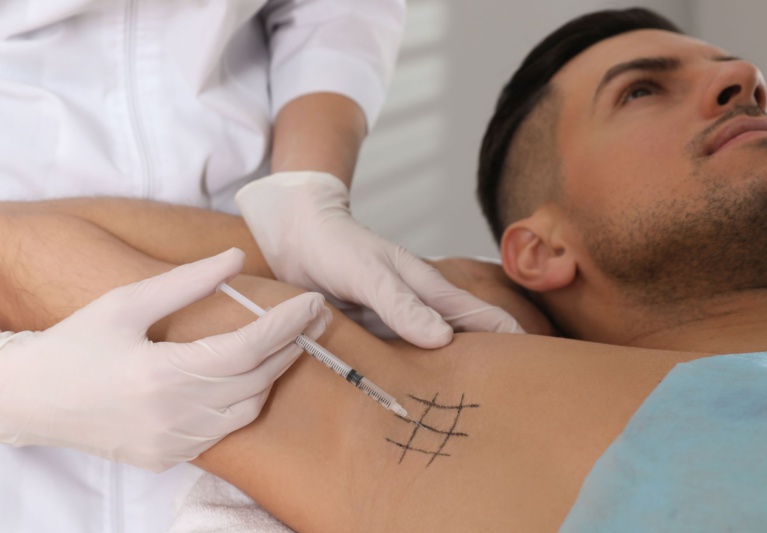 Say Goodbye to Sweating with Hyperhidrosis Treatment