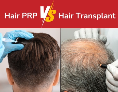 Hair PRP vs Hair Transplant: Which Is Right for You?