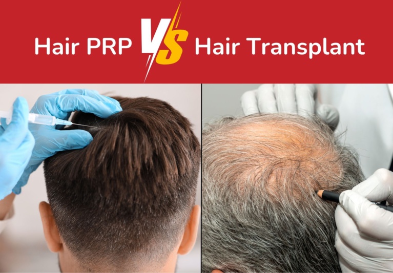 Hair PRP vs Hair Transplant: Which Is Right for You?